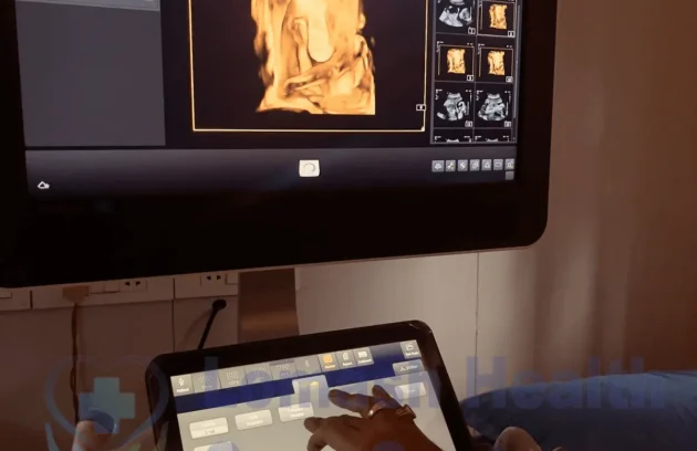 Best 3D/ 4D Ultrasound in Kathmandu