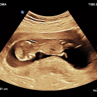 Pregnancy care imaging and 4D ultrasound scan.