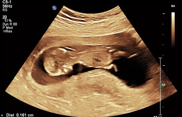 Pregnancy care imaging and 4D ultrasound scan.