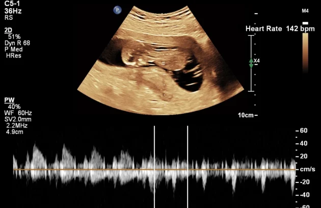 Pregnancy care imaging and 4D ultrasound scan.