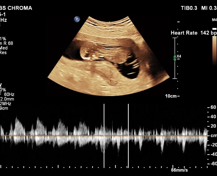 Pregnancy care imaging and 4D ultrasound scan.