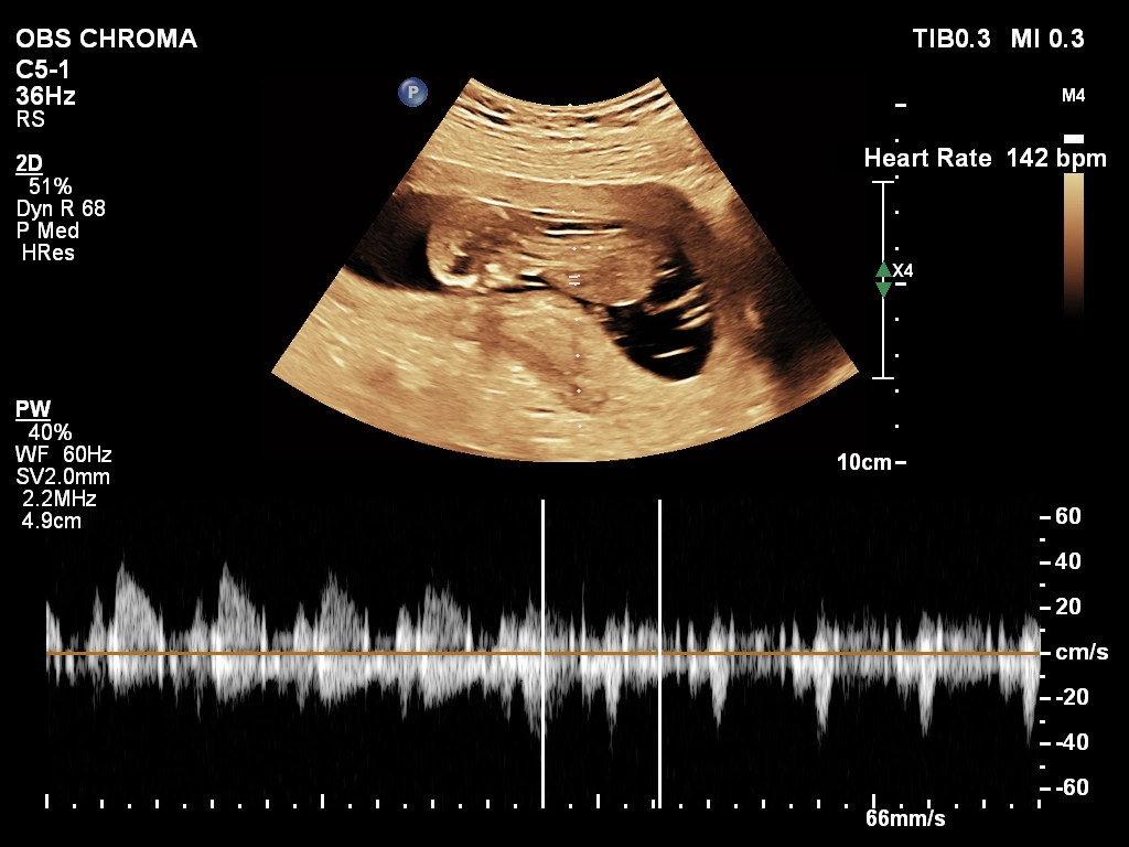 Pregnancy care imaging and 4D ultrasound scan.