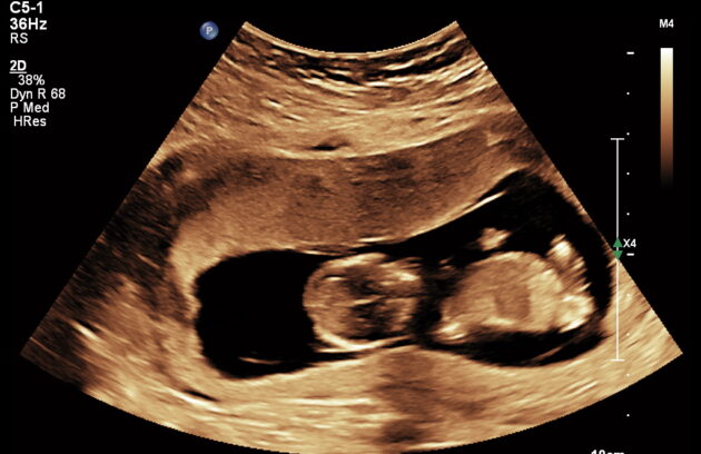 Detailed ultrasound results at Lomash Health Kathmandu.