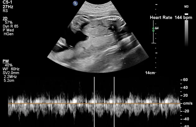 Pregnancy care imaging and 4D ultrasound scan.