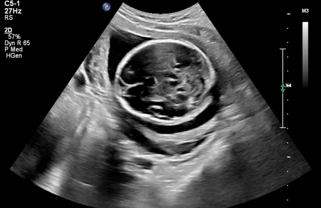 Pregnancy care imaging and 4D ultrasound scan.