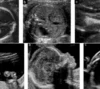 Pregnancy care imaging and 4D ultrasound scan.