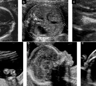 Pregnancy care imaging and 4D ultrasound scan.