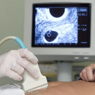 Pregnancy care imaging and 4D ultrasound scan.