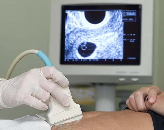 Pregnancy care imaging and 4D ultrasound scan.