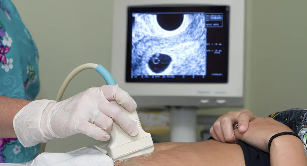 Pregnancy care imaging and 4D ultrasound scan.