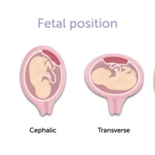Pregnancy care imaging and 4D ultrasound scan.