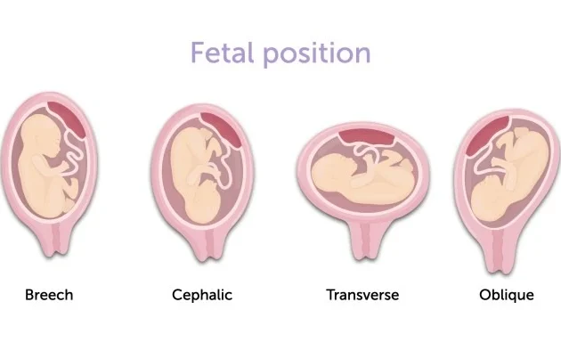 Pregnancy care imaging and 4D ultrasound scan.