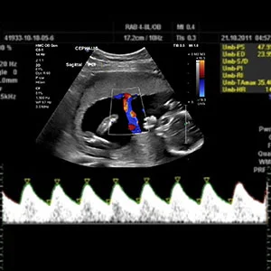 Detailed ultrasound results at Lomash Health Kathmandu.