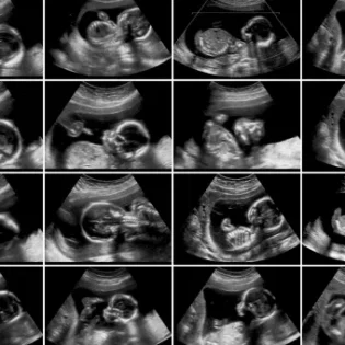 Pregnancy care imaging and 4D ultrasound scan.
