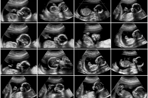 Pregnancy care imaging and 4D ultrasound scan.