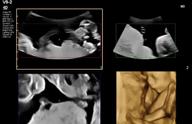 Ultrasound Near Me