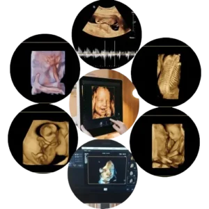 Ultrasound_in_pregnancy_photos_collection