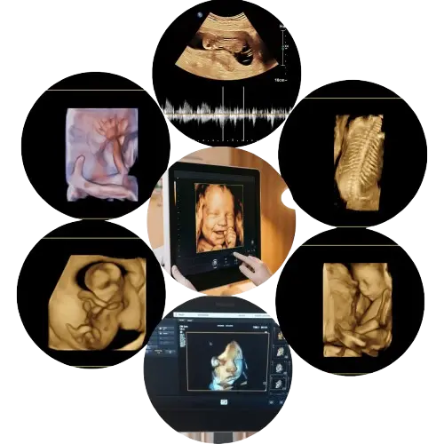 Ultrasound_in_pregnancy_photos_collection